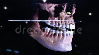 3D牙科数字建模<strong>修复</strong>.. 三维<strong>牙齿</strong>模型，病人扫描<strong>牙齿</strong>。 医生正在研究